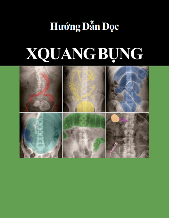 [VIP] Hướng dẫn đọc Xquang bụng